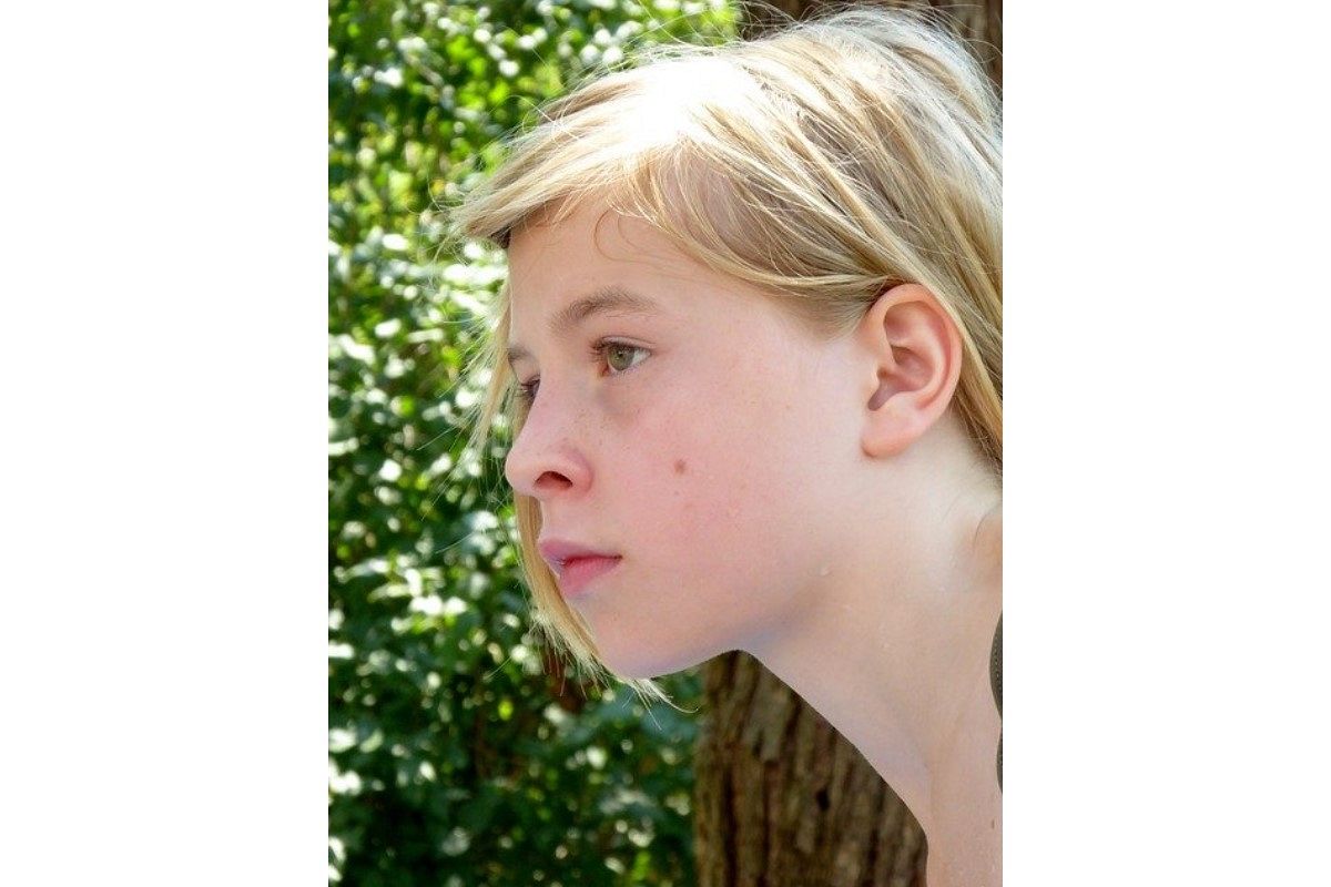 ホクロの夢は何を暗示している?