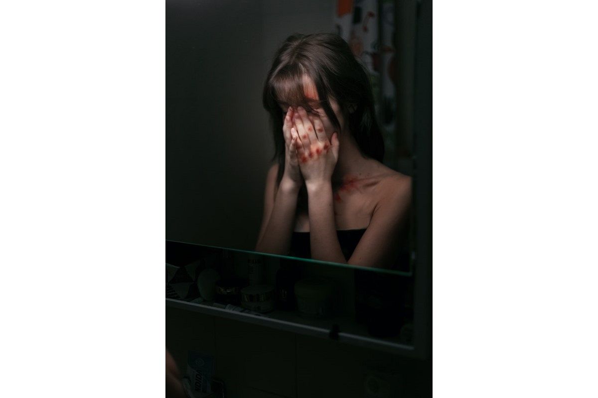 あざの夢は何を暗示している?