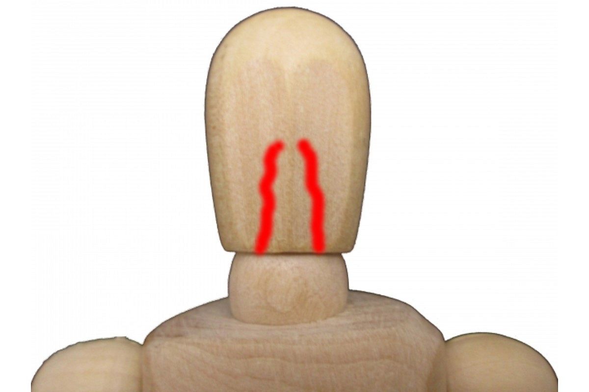 出血の夢は何を暗示している?