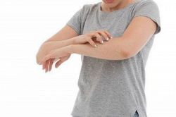 夢占い・夢診断│虫刺されの夢は何を意味している？