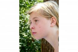 夢占い・夢診断│ホクロの夢は何を暗示している？