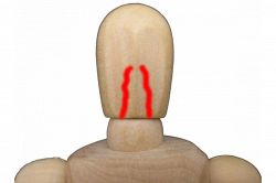 夢占い・夢診断│出血の夢は何を暗示している？